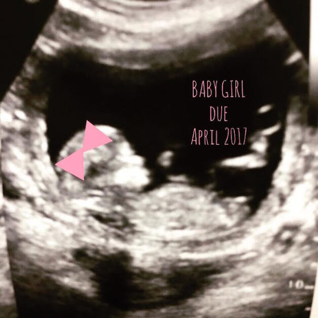 BABYGIRL3-1